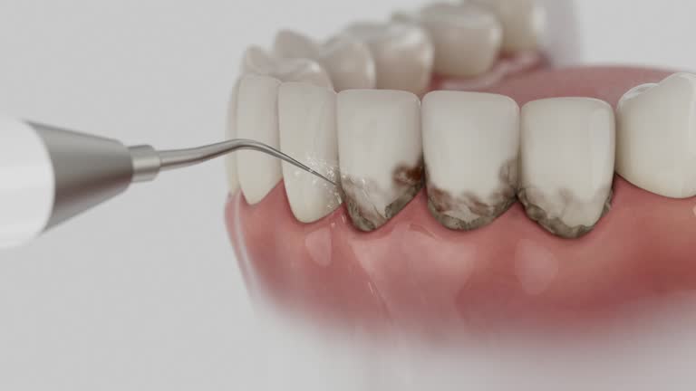 Reliable Dental Implants contractor in Miramar Beach, FL by Smile Center Dentistry